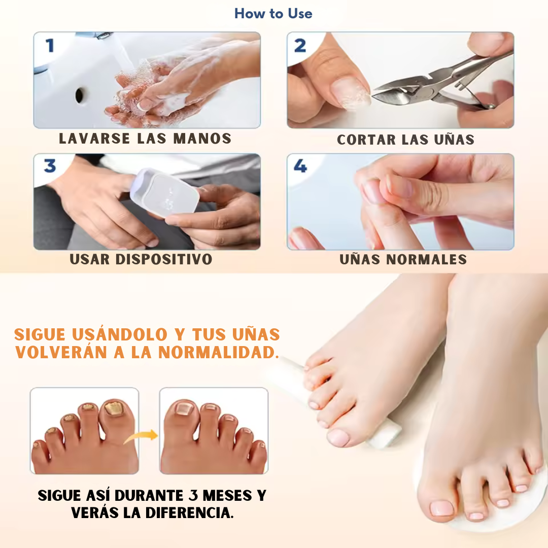 💅LUMINAILS™ Laser de uñas
